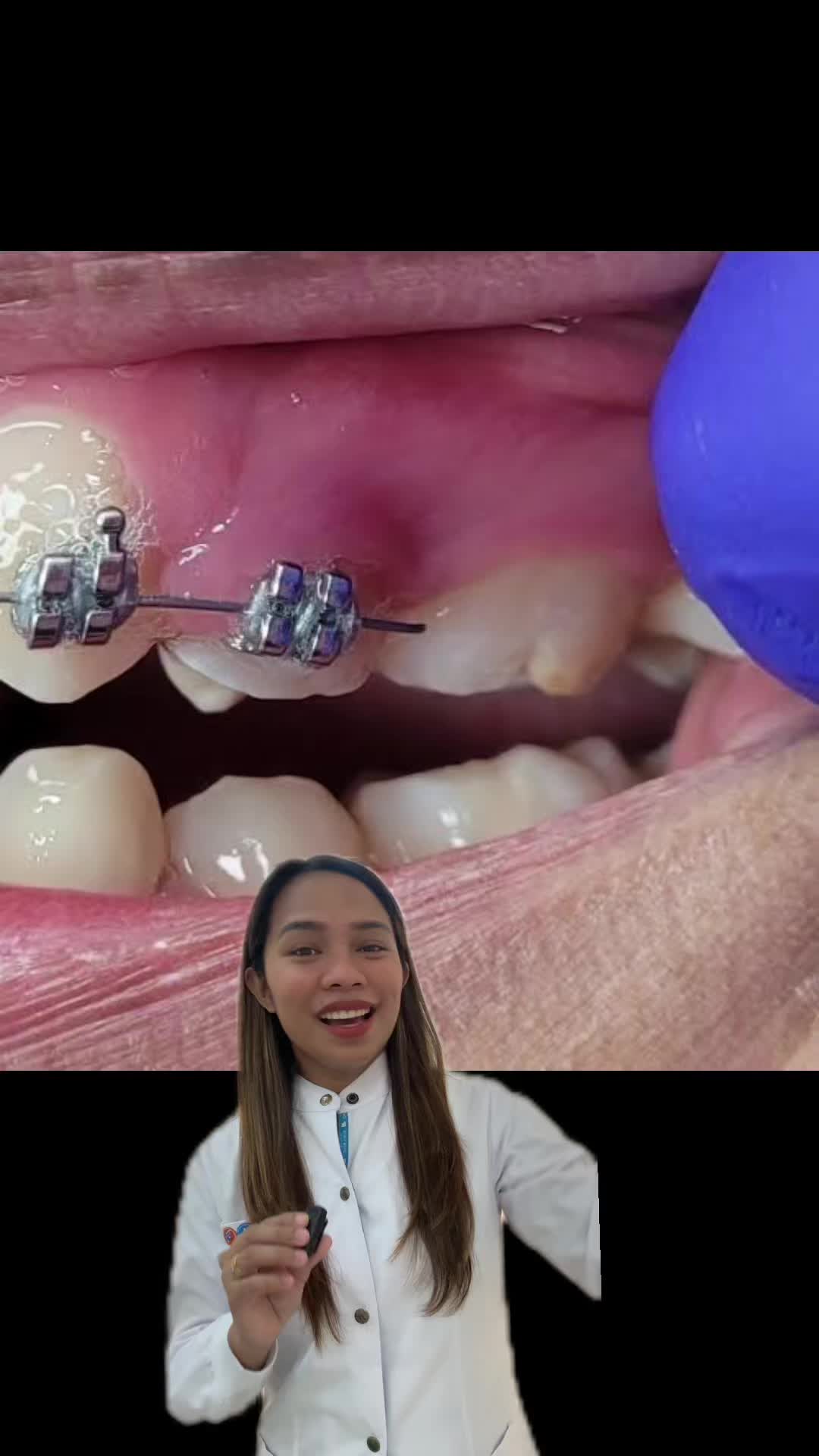 Try it to believe it ganyorn!