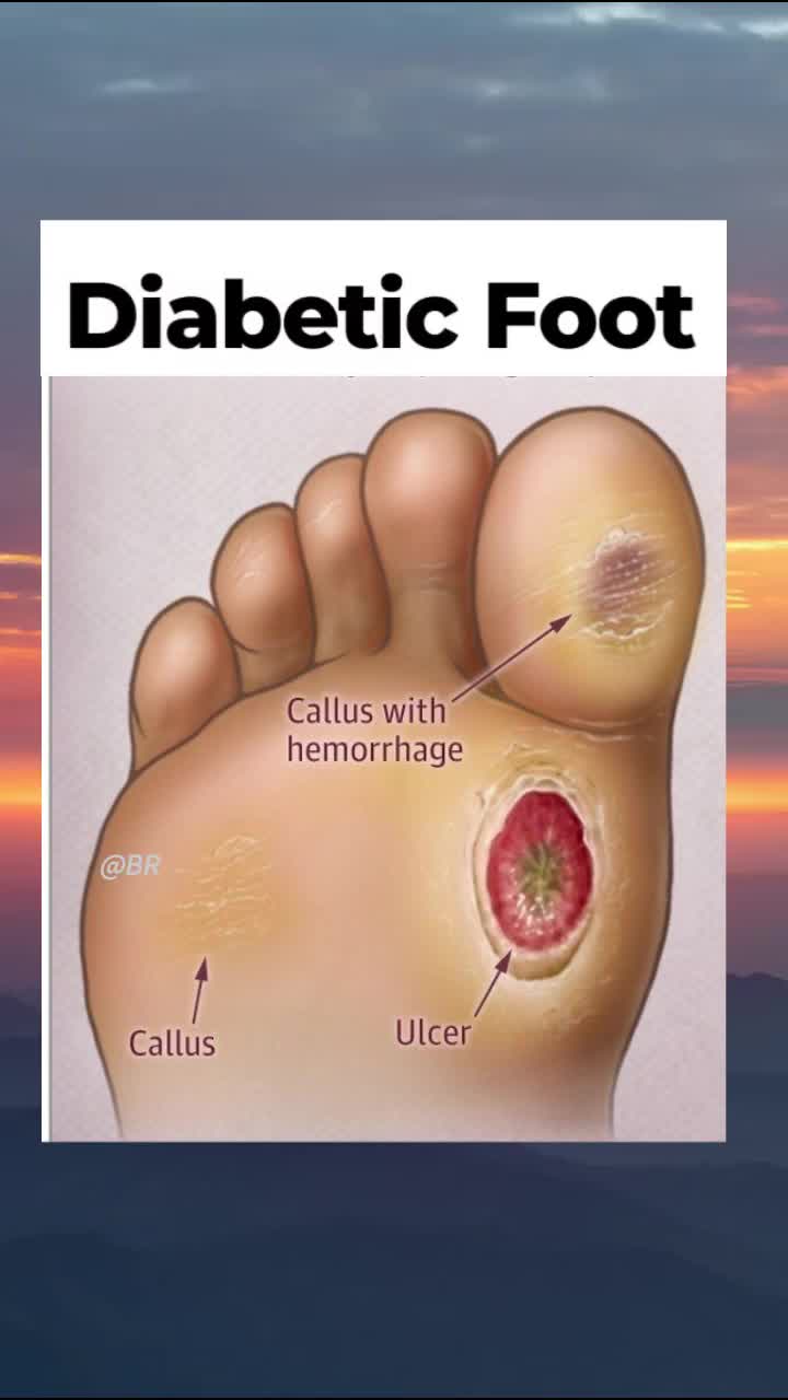 free download to use