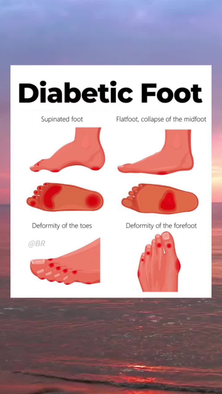 free download to use