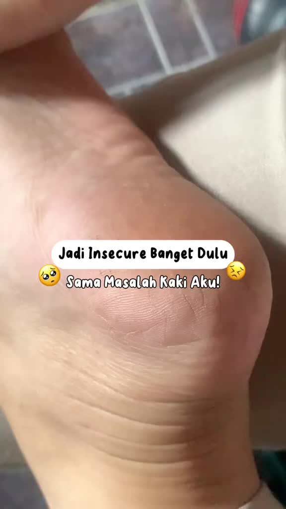 Azalea Smooth Foot Cream (For Hand & Foot) - Krim Zaitun Perawatan & Pelembut Kaki, Siku, & Telapak Tangan Kering Pecah - Pecah