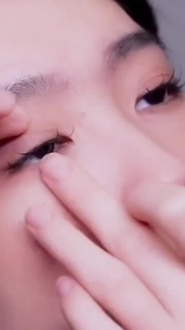 Tetes Mata Obat Mata Katarak Mata Kering Sakit Mata Darah Merah Ketegangan Mata Eye