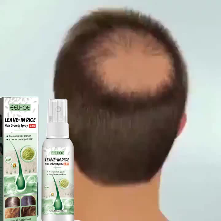 Serum penumbuh rambut Obat penumbuh rambut Penumbuh rambut botak Hair growth serum 100ml Kontrol minyak Scalp essence Pertumbuhan rambut Menstabilkan akar rambut Menutrisi secara mendalam