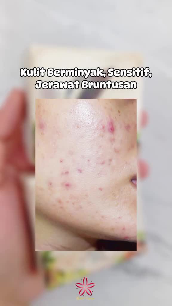SR12 Rice Soap 60gr Sabun Beras Pencui Muka Ampuh Untuk Wajah Berjerawat Beruntusan & Wajah Berminyak