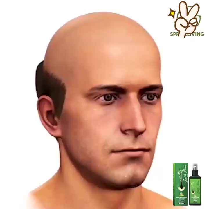 120ml Jaysuing Ginger Hair Growth Spray Anti rambut rontok Minyak Penumbuh dan Perawatan Rambut serum penumbuh rambut botak