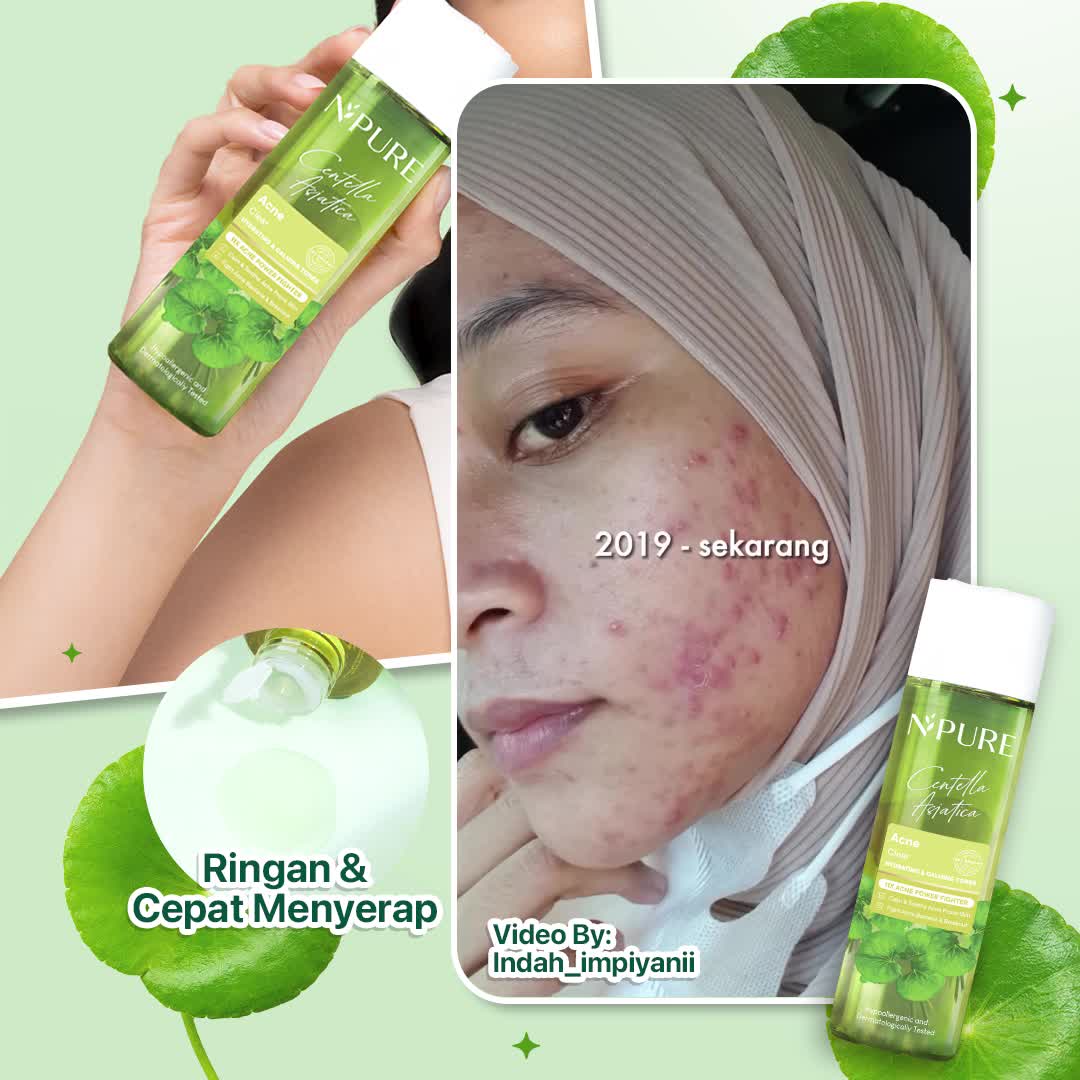 【Paket 2pcs】NPURE Centella Asiatica Acne Face Toner  150 ML + Centella Asiatica Acne Face Toner 30ml /Hydrating Toner / Mencerahkan Wajah  Berjerawat / toner npure / toner kulit berjerawat