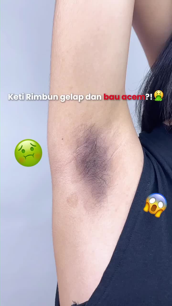 MR. Epple Sugar Waxing / Hair Removal / Pencabut Bulu