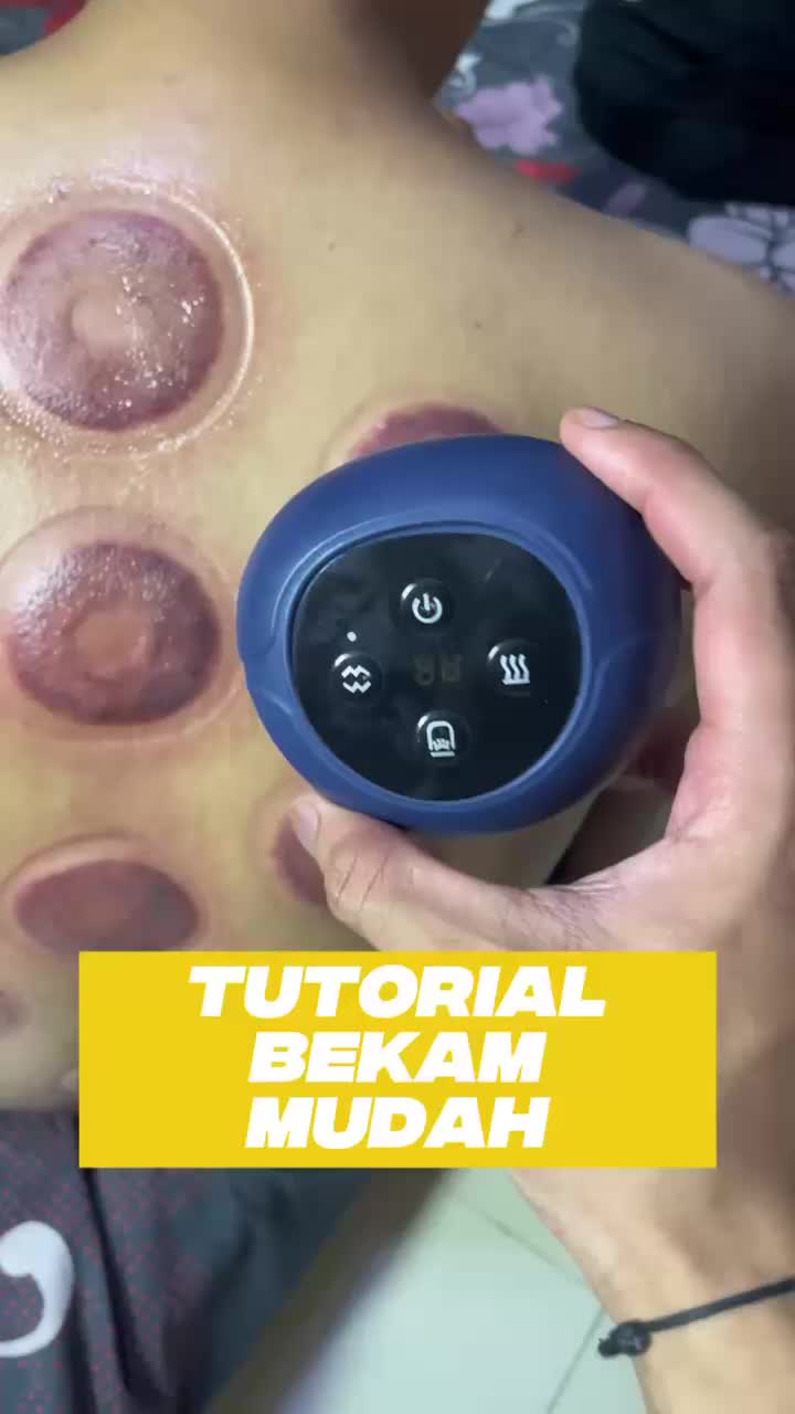 Alat Bekam Elektrik Pintar / Alat Penghilang Cape Pegal/ Alat Terapi Bekam dengan Pemanas