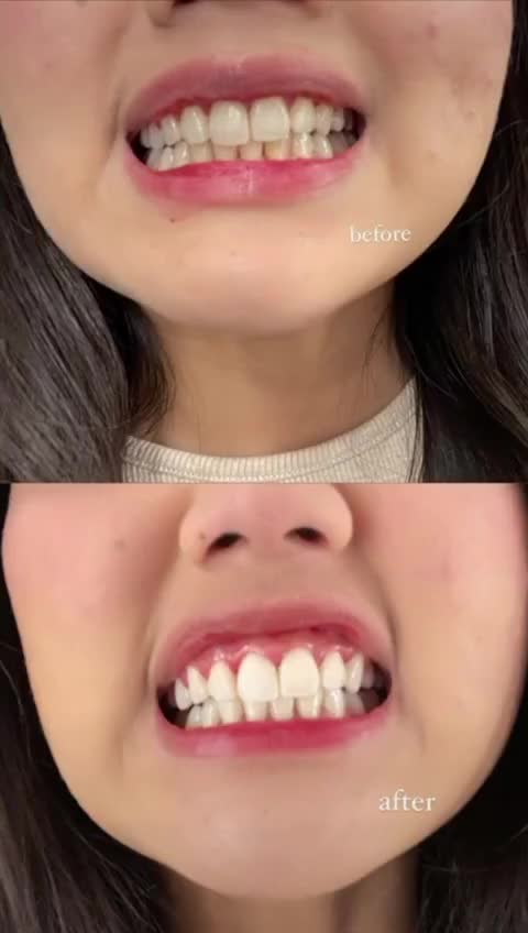 PUTIH Siganture Whitening Kit Formulasi dari Dokter Gigi