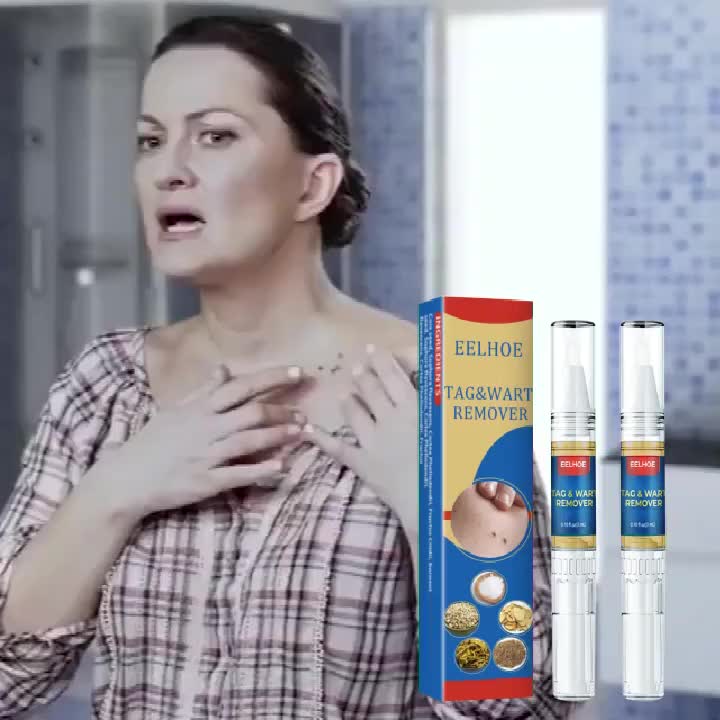 Krim Penghilang Tahi Lalat Kutil Papiloma