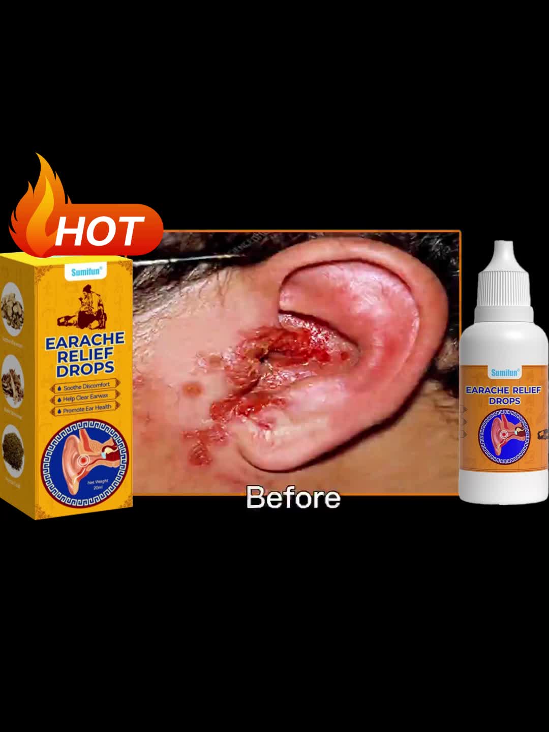【Pengobatan untuk telinga bernanah dan tinitus】Tinnitus relief spray Ear Ringing Relief Anti Tinnitus Earwax Removal Spray Tetes Telinga Perenang – Basmi Gatal & Kotoran Membatu dalam