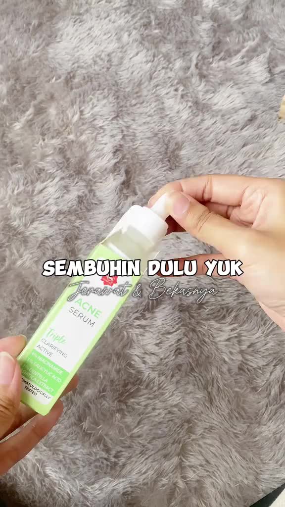 Serum Viva Acne dengan Triple Clarifying Active 20 mL - Kosmetik, Aging