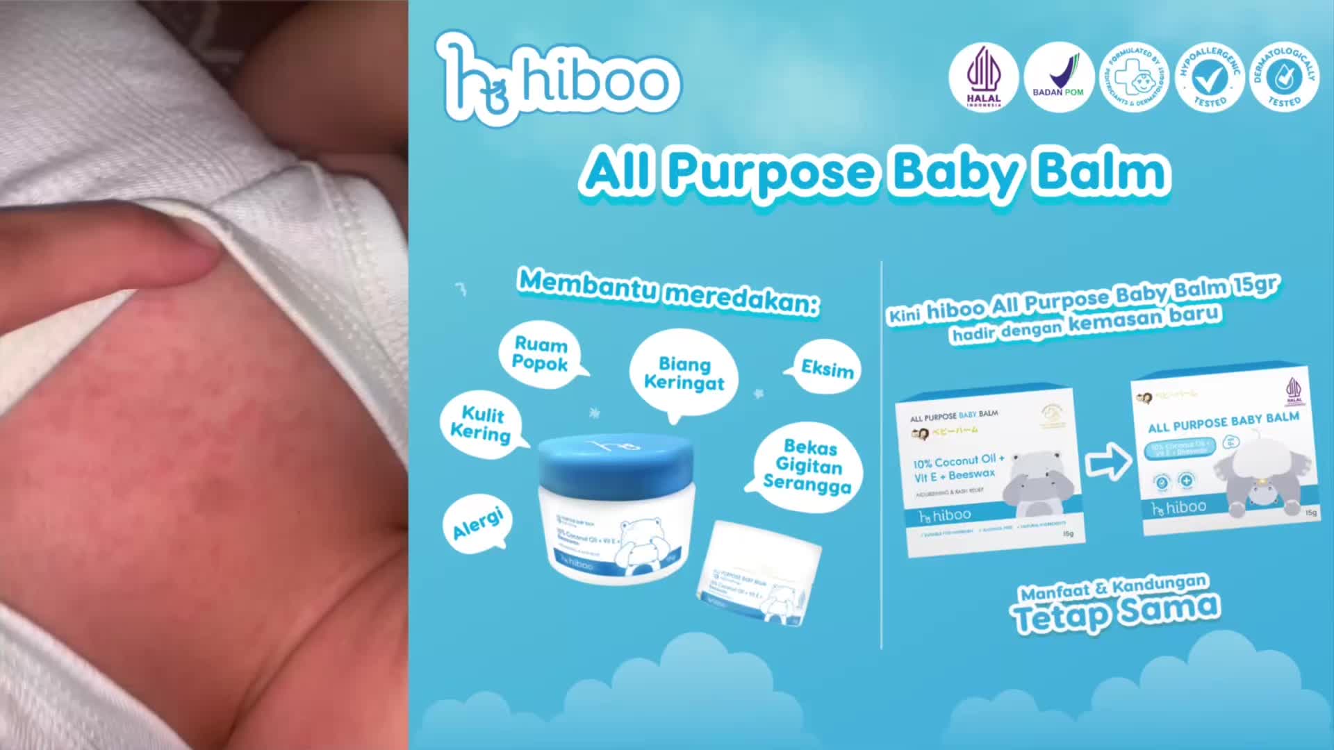 [BUY 1 GET 1 FREE] Hiboo Multipurpose Balm 15g + Zzz Baby Calming 15 gr - Ruam Popok Bekas Luka Nourishing Balm Baby Cream Baby Soothing Skincare A00