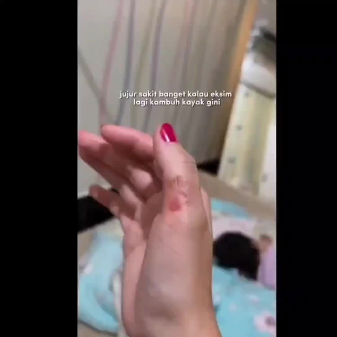 Salep Gatal Racikan Spesialis Kulit Paling Ampuh - Eksim Basah, Kering, Gatal Menahun, Scabies - Isi 10 Gram - Deodorant, Jamur