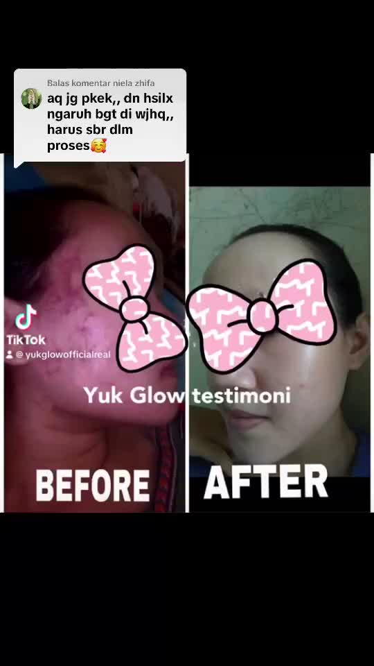YUK GLOW PAKET LENGKAP FLEK & GLOW / penghilang flek hitam /ampuh menghilangkan flek /ampuh mencerahkan/paket flek