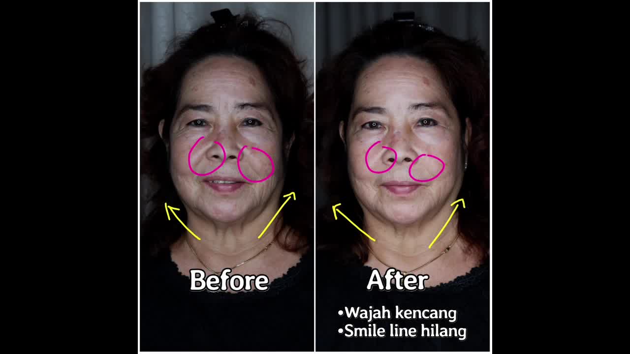 MAGIC BELT | Alat pengencang wajah