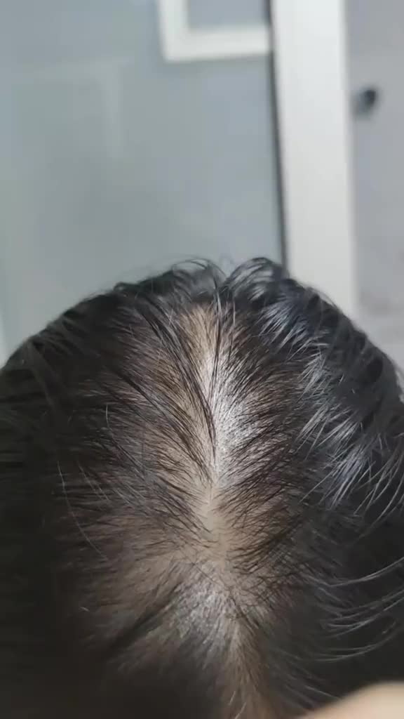 AHE Shampoo fall hair treatment shampo Oil Control Mengurangi Rambut Rontok shampoo perawatan rambut pria wanita Original isi 300ML