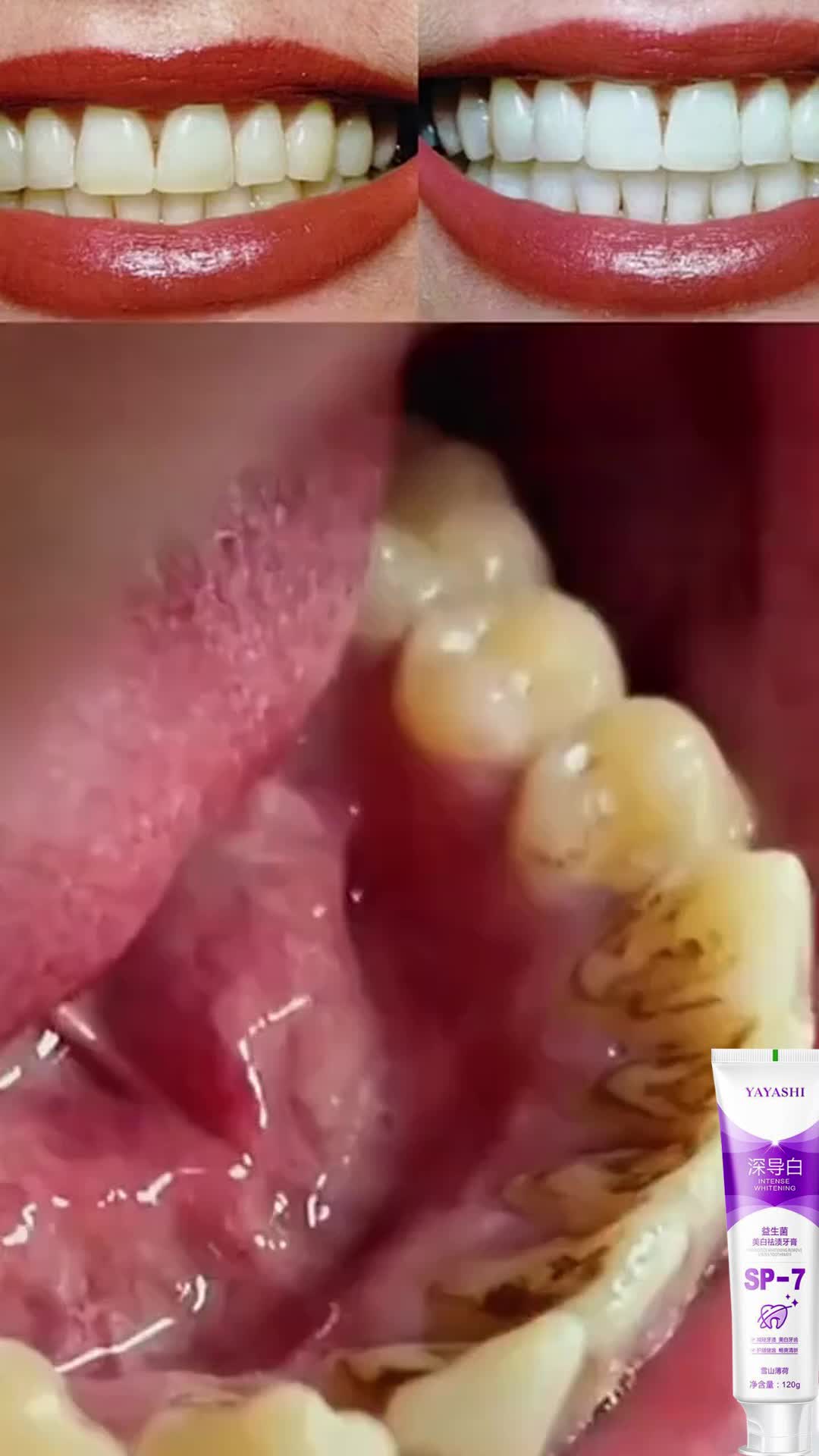 SP-7 Pasta Gigi Pemutih Probiotik Memutihkan GigiKuning Penghilang Karang Gigi Dan Pemutih GigiPermanen 120g Odol Pembersih Karang GigiPerawatan Pemutihan Gigi/ Menghilangkan BauMulut /Menghilangkan Noda Teh sp7 pemutihgigi Gusi Penyegar
