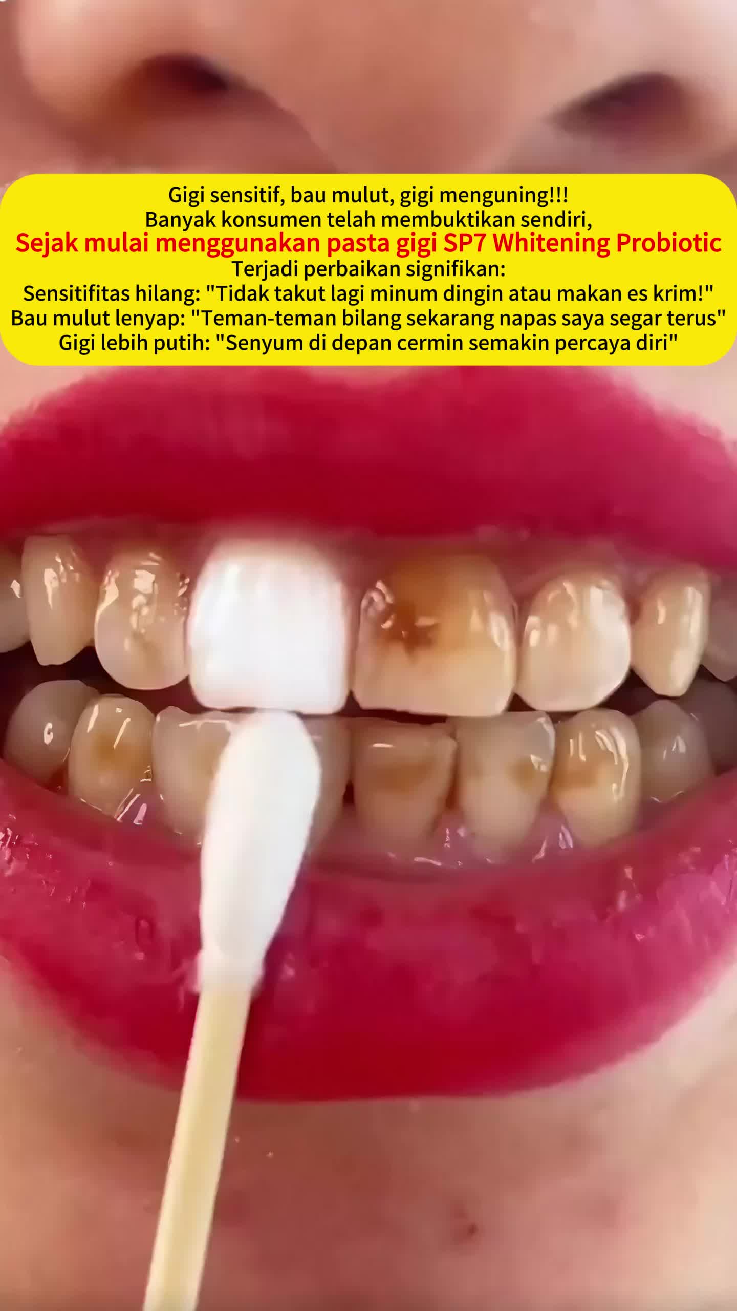 Pembersih Gigi Karang SP-7 Pasta Gigi Probiotik Pasta Gigi Pemutih, Nafas Segar, Menghilangkan Bau Mulut 100gr Mencerahkan Memutihkan Perawatan Whitening Tooth Paste