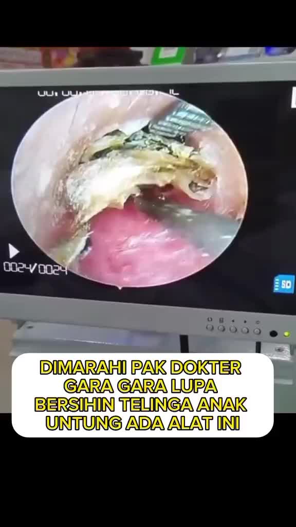 Alat Pembersih Telinga Korek Kuping 6 in1 Plus Pouch Stainless Ear Pick 6in1 Set Pembersih Telinga Isi 6 Tas Kulit